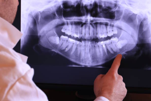 Best Emergency Denture Repair in Long Lake, IL