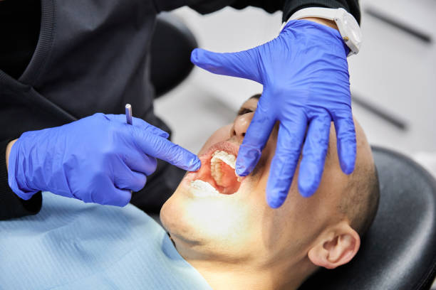 Best Emergency Tooth Extraction in Long Lake, IL